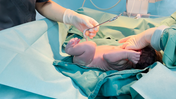 醫(yī)生為胎兒輸臍血。重慶安琪兒婦產(chǎn)醫(yī)院供圖