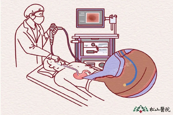 胃鏡檢查。重慶松山醫(yī)院供圖