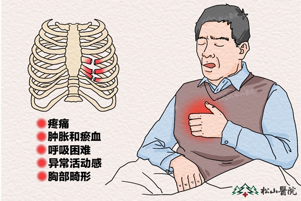 肋骨骨折癥狀。重慶松山醫(yī)院供圖
