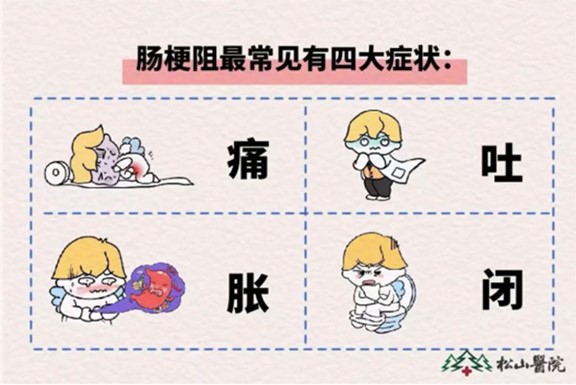 腸梗阻癥狀。重慶松山醫(yī)院供圖