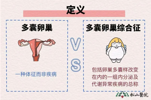 多囊與多囊卵巢綜合征的定義。重慶松山醫(yī)院供圖