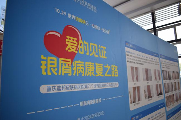 活動現(xiàn)場。重慶迪邦皮膚病醫(yī)院供圖