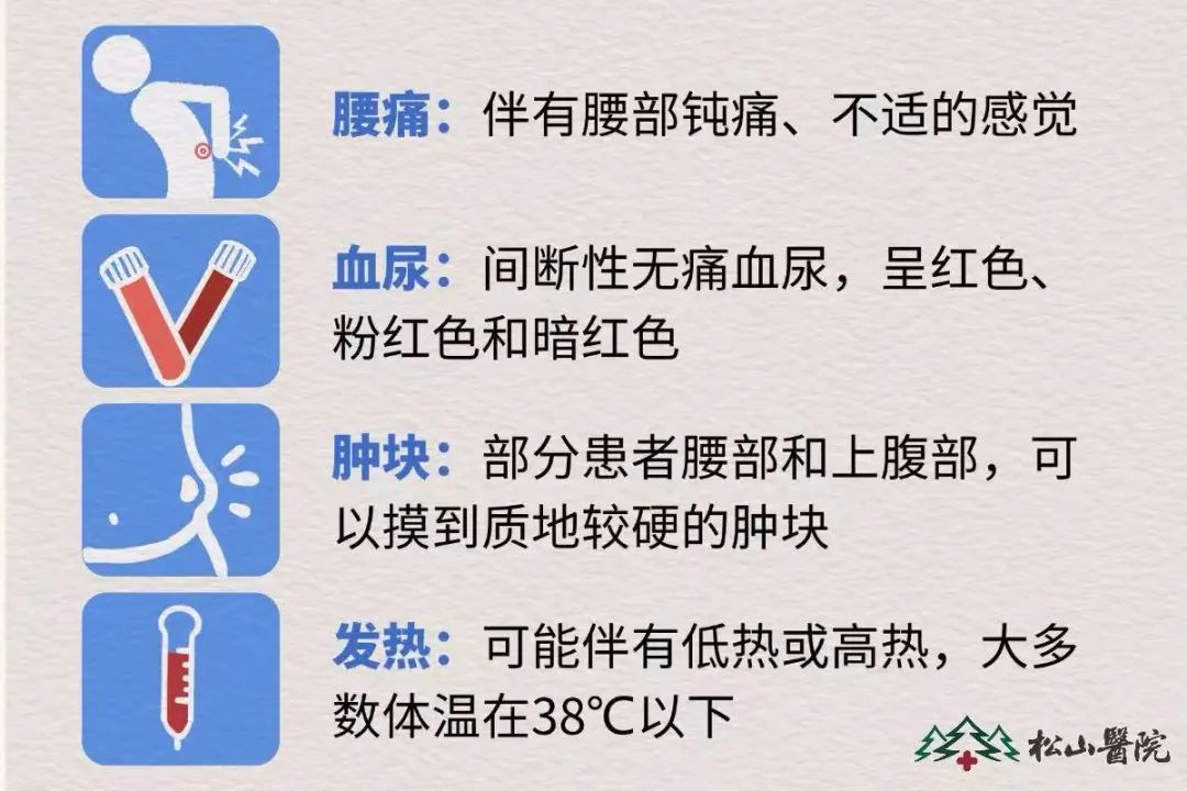 腎癌表現(xiàn)。重慶松山醫(yī)院供圖