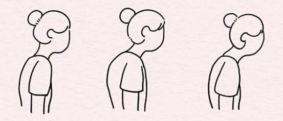 示意圖。重慶松山醫(yī)院供圖