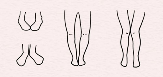 示意圖。重慶松山醫(yī)院供圖