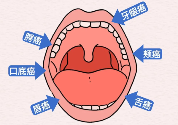 示意圖。重慶松山意圖供圖