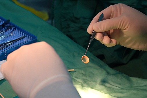 手術(shù)現(xiàn)場。重慶普瑞眼科醫(yī)院供圖