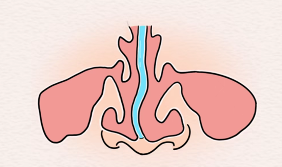示意圖。重慶松山醫(yī)院供圖