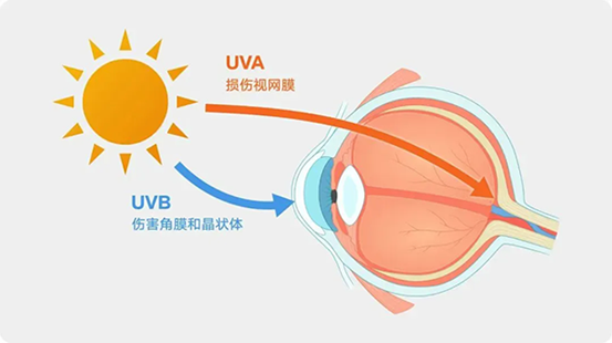 紫外線對眼睛的傷害。重慶南坪愛爾眼科醫(yī)院供圖