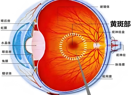 黃斑部。重慶普瑞眼科醫(yī)院供圖